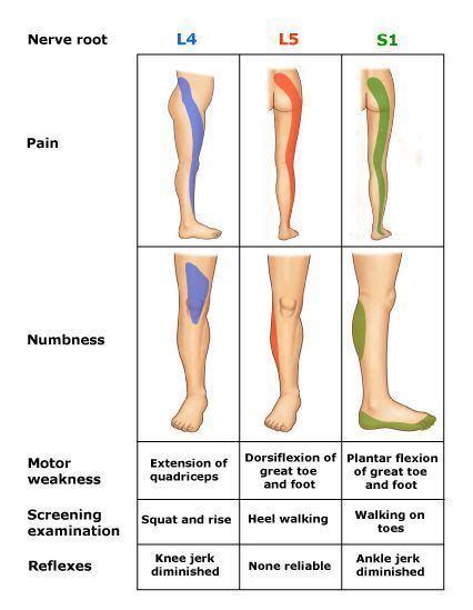 l5 nerve root compression test|symptoms of l5 nerve compression.